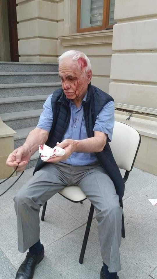 Rəhim Qazıyevi küçədə döydülər- FOTOLAR