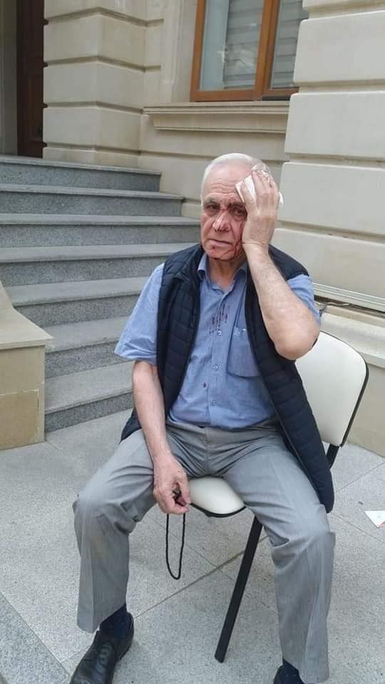 Rəhim Qazıyevi küçədə döydülər- FOTOLAR