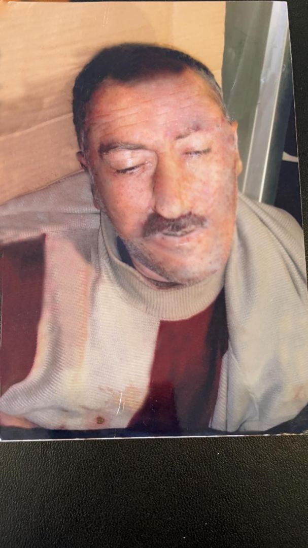 Bakı-Qazax yolunda orta yaşlı kişini maşın vurub öldürdü - FOTO - Gallery Image