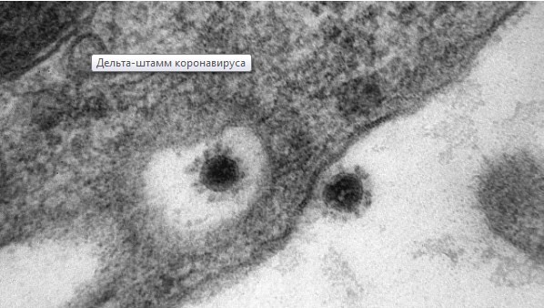 Koronavirusun delta ştammınınfotosu dərc olundu